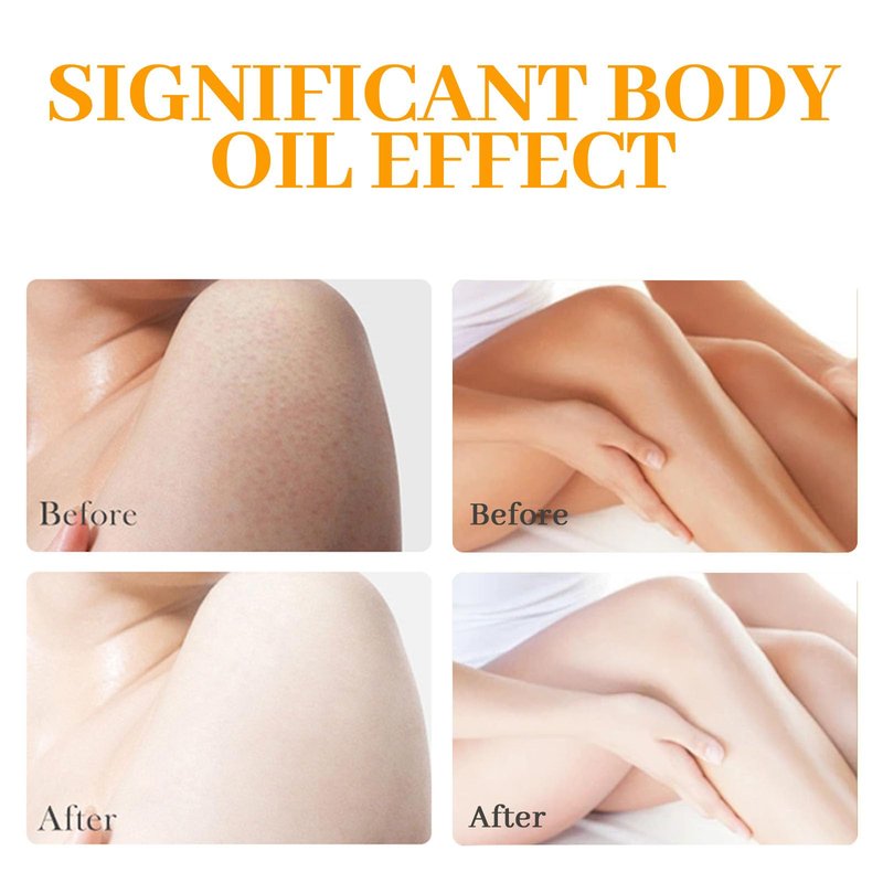 Turmeric Body Oil 1000ml, Pure Veetgold Turmeric Super Body Oil for Skin, 7days Retinol Tumeric Vit C Oil (1000ML Turmeric)