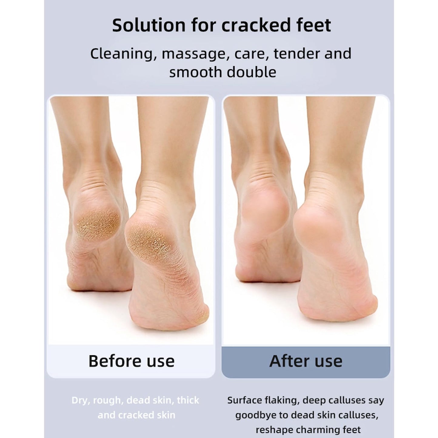 Electric Callus Remover for Feet - Professional Pedicure Foot File & Pumice Stone Scrubber Tool for Dead Skin, Dry Hard Cracked Heel Repair