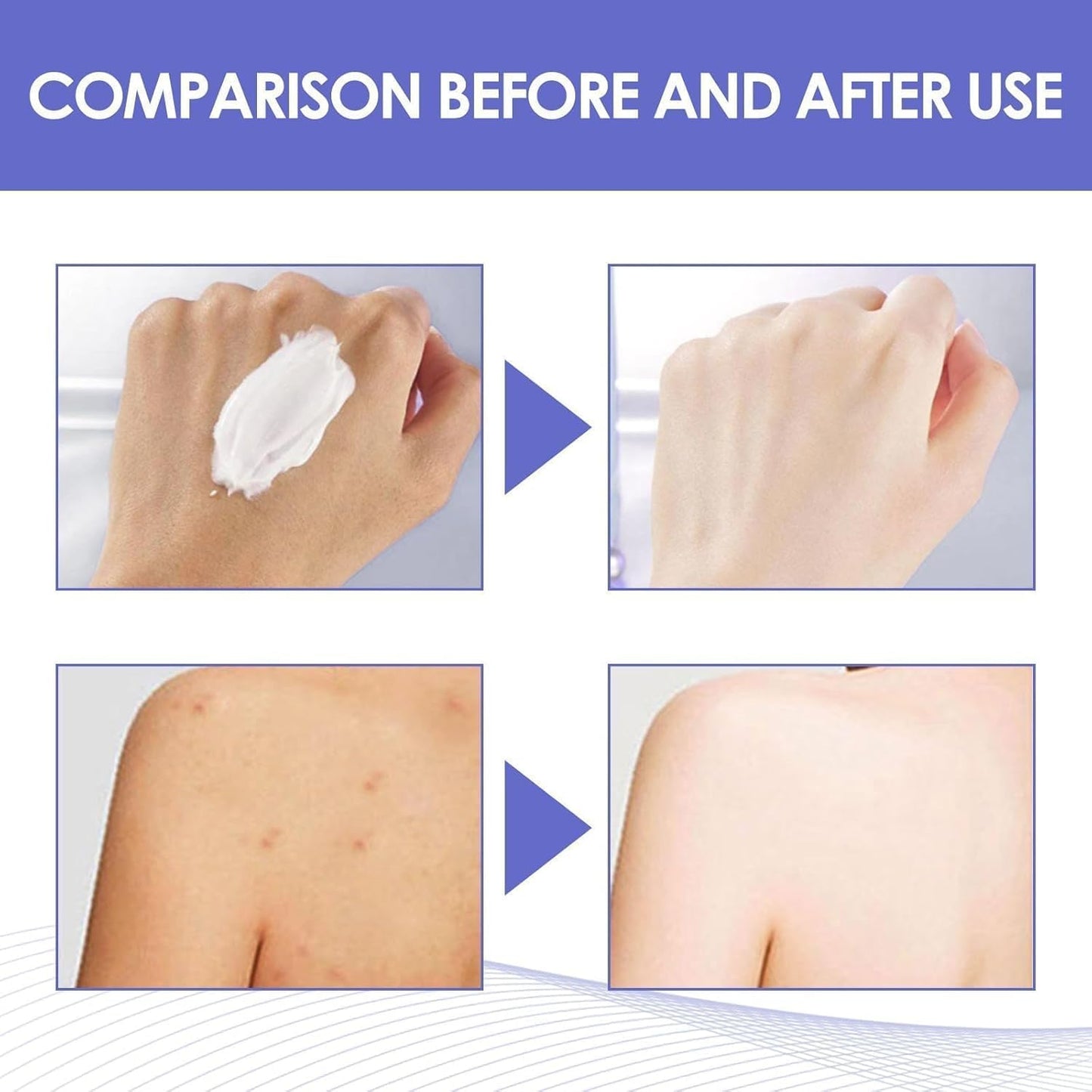 Skin VVhitening Cream for Intimate Areas – Vitamin C Body Care Cream for Dark Underarm, Armpit, Inner Thigh, Private Area, Elbow, Knees, Face, Bikini Line and Neck, Quick Results, 50 ML / 1.7 FLOZ