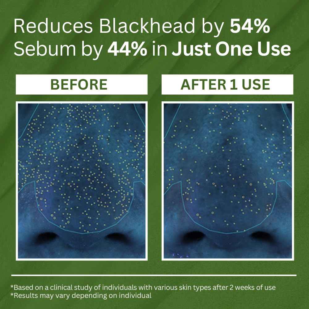 P.CALM Holy Basil Bubble Deep Mask – Holy Basil & Carbonated Water for Cleansing Pores & Blackheads, Korean Clay to Bubble Wash-Off Pack (90g / 3.17 oz)