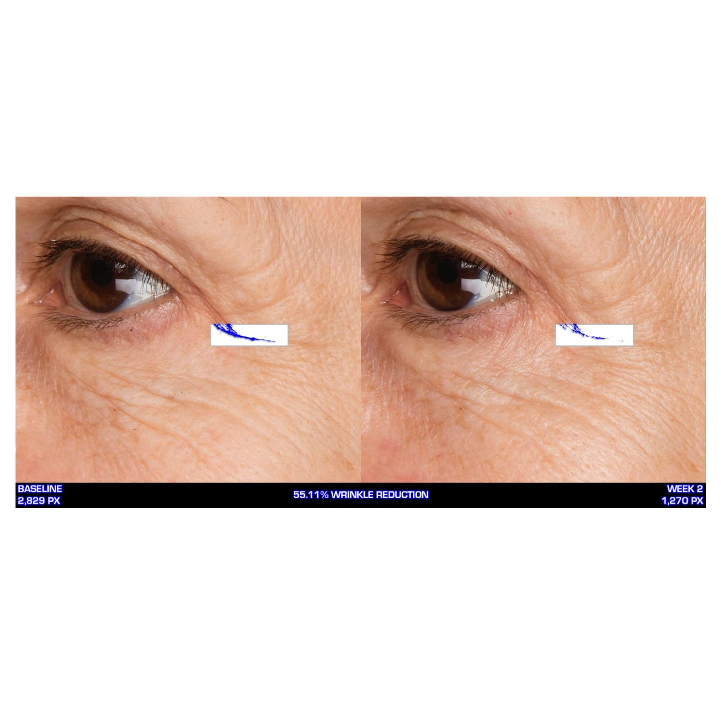 Serious Skincare - Ultra-Mare Pure Marine Infusion Revitalizing Eye Cream - Peptides - Skin Renewing - Encourages Collagen Production - Helps Reduce Wrinkle Depth - 0.5 oz