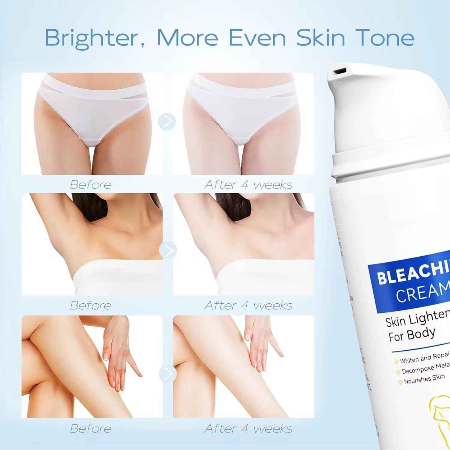 Skin Bleaching Cream for Intimate Areas – Vitamin C Dark Spot Remover for Underarms, Knees, Elbows & Bikini Line