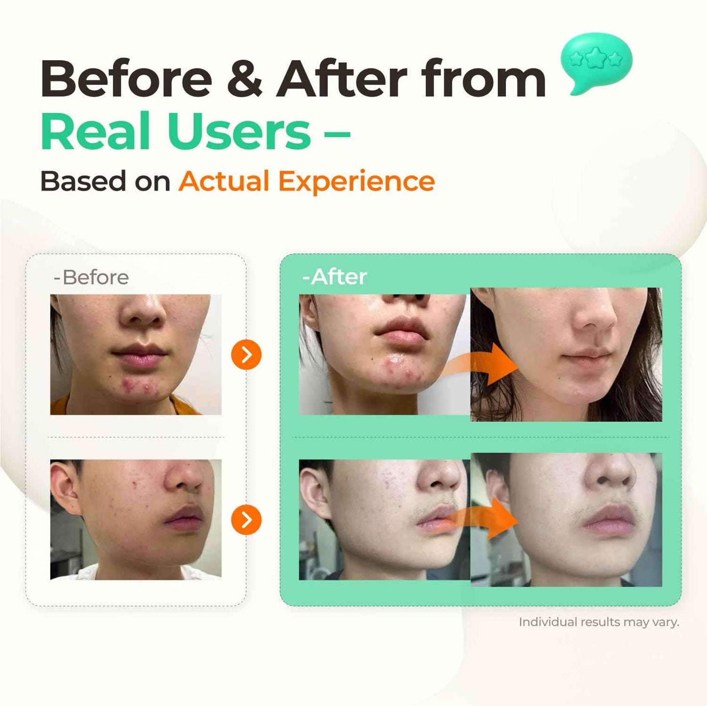 SINSURU Watery Sulfur 82 Soothing Serum – Gentle Daily Face Serum for Acne-Prone & Sensitive Skin with 82% Sulfur Hot Spring Water, Fragrance-Free Formula | Korean Skincare (1.69 fl.oz / 50ml)