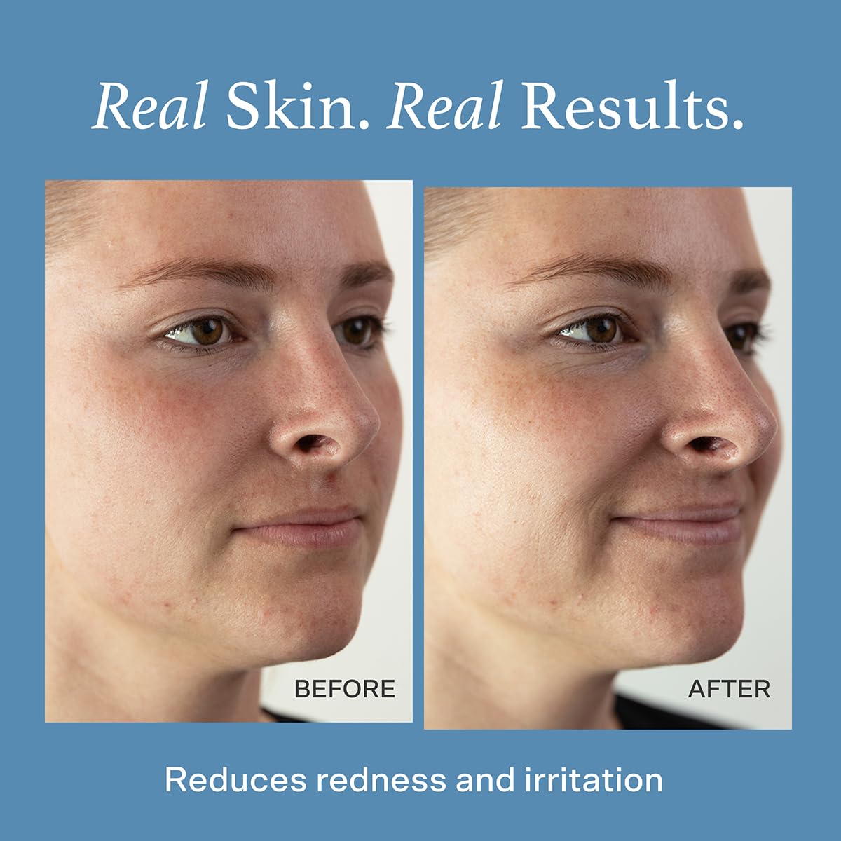Otella Detox & Soothe Face Mist with Hypochlorous Acid .02% | 2.7 oz | Helps Reduce Redness, Irritation, Breakouts | Rosacea, Eczema, Sensitive-skin Safe | pH Balanced, Fragrance=Free, Fine Mist Toner