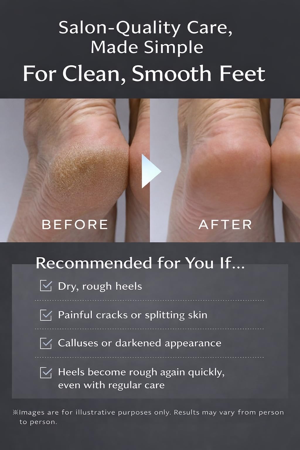 TSURULABO - Premium Black Foot Scrubber, Callus Remover Foot File with Coarse & Fine Sides, Water-Resistant Alternative to Pumice Stone for Feet, Heel Exfoliator, Pack of 1 Pedicure File for Grooming