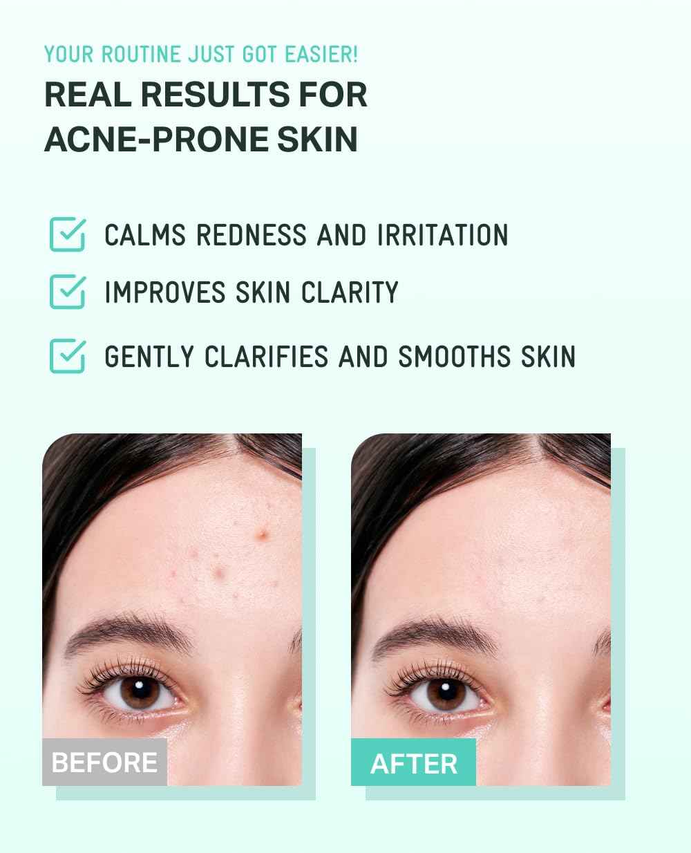 BRING GREEN Tea Tree CICA Soothing Toner | Mild Daily Skincare Routine for Cooling and Hydrating Effect (8.5 Fl. Oz., 250ml)