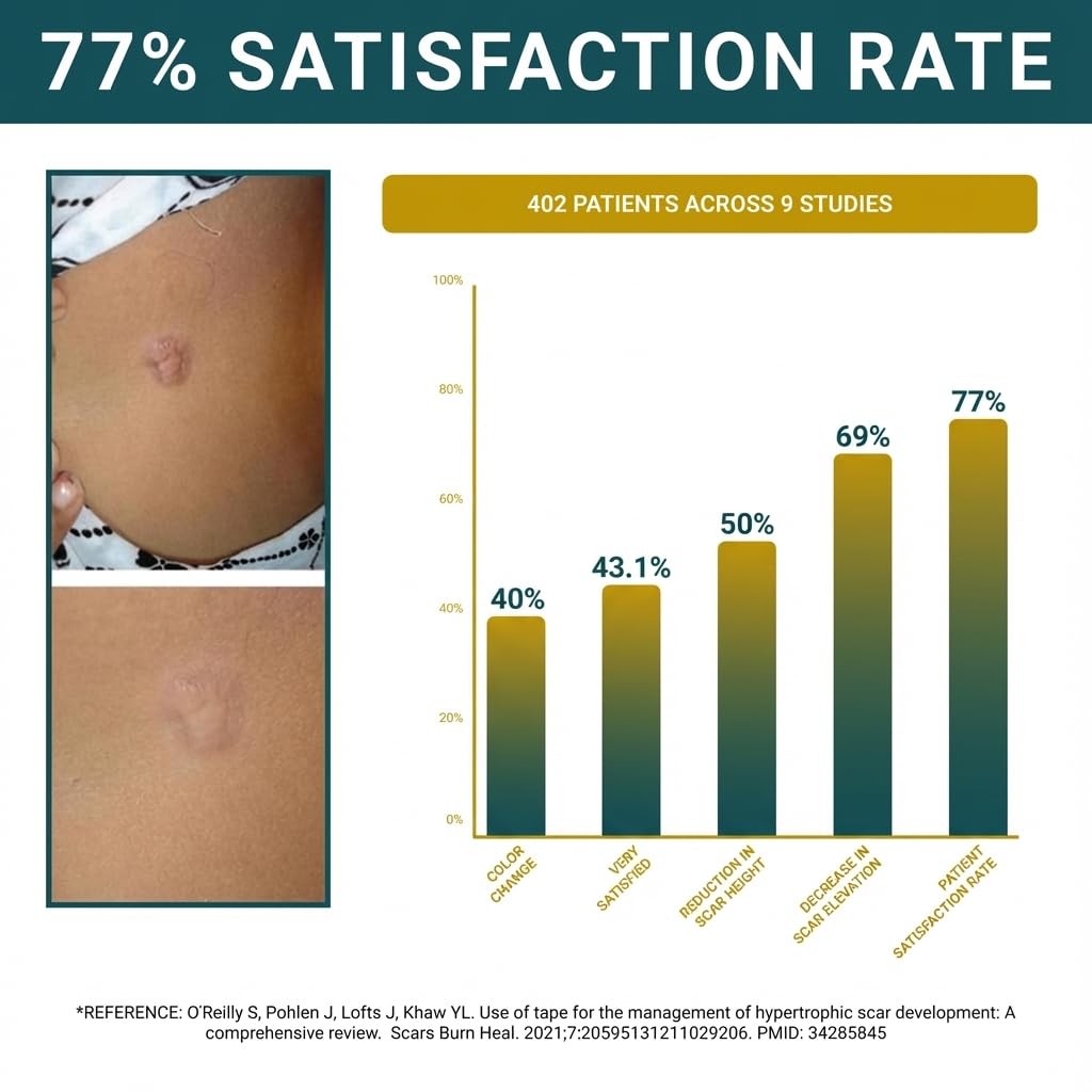Silicone Scar Sheets, Silicone Scar Tape For Surgical Scars - Clinically Validated Technology Scar Treatment Strips For Hypertrophic, C-Section, Tummy Tuck, Keloid Scars - Reusable, Waterproof
