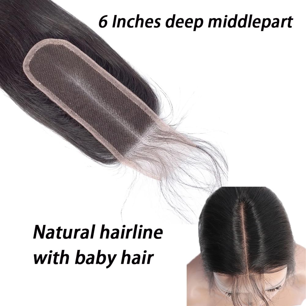 FEHOKA Brazilian 2x6 HD Lace Closure Straight Lace Closure 100% Virgin Human Hair Closure Natural Hairline Middle Part Kim K 2 By 6 Closure With Baby Hair (16 Inch, 2x6 Closure)