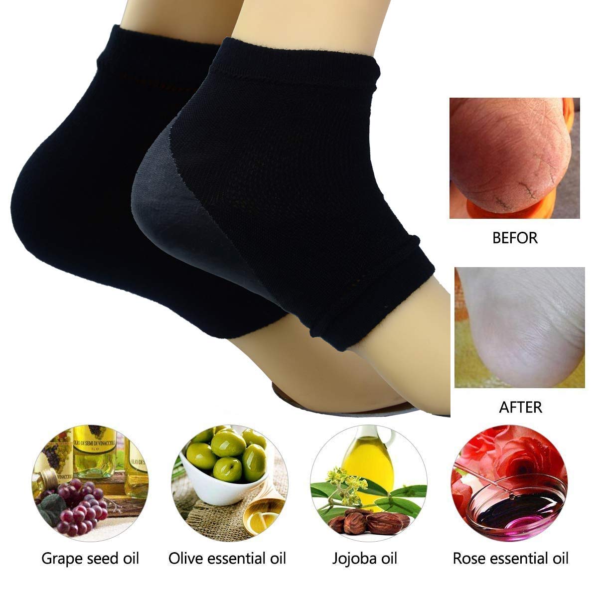 Makhry 2 Pairs Moisturizing Silicone Gel Heel Socks for Dry Hard Cracked Skin Open Toe Comfy Recovery Socks Day Night Care (Black)