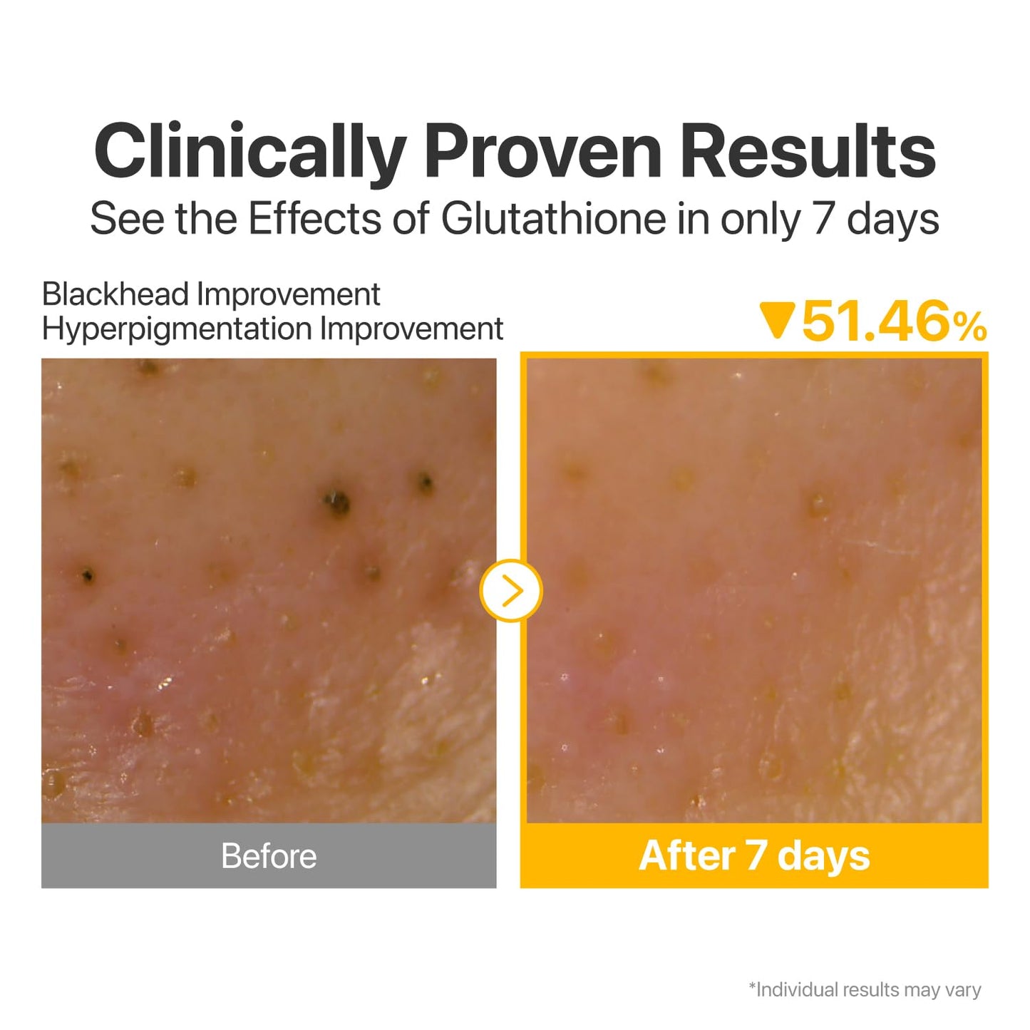 Numbuzin No.5 Cleansing Oil - Glutathione & Vitamin C for Pores, Dark Spots | 6.76 fl oz