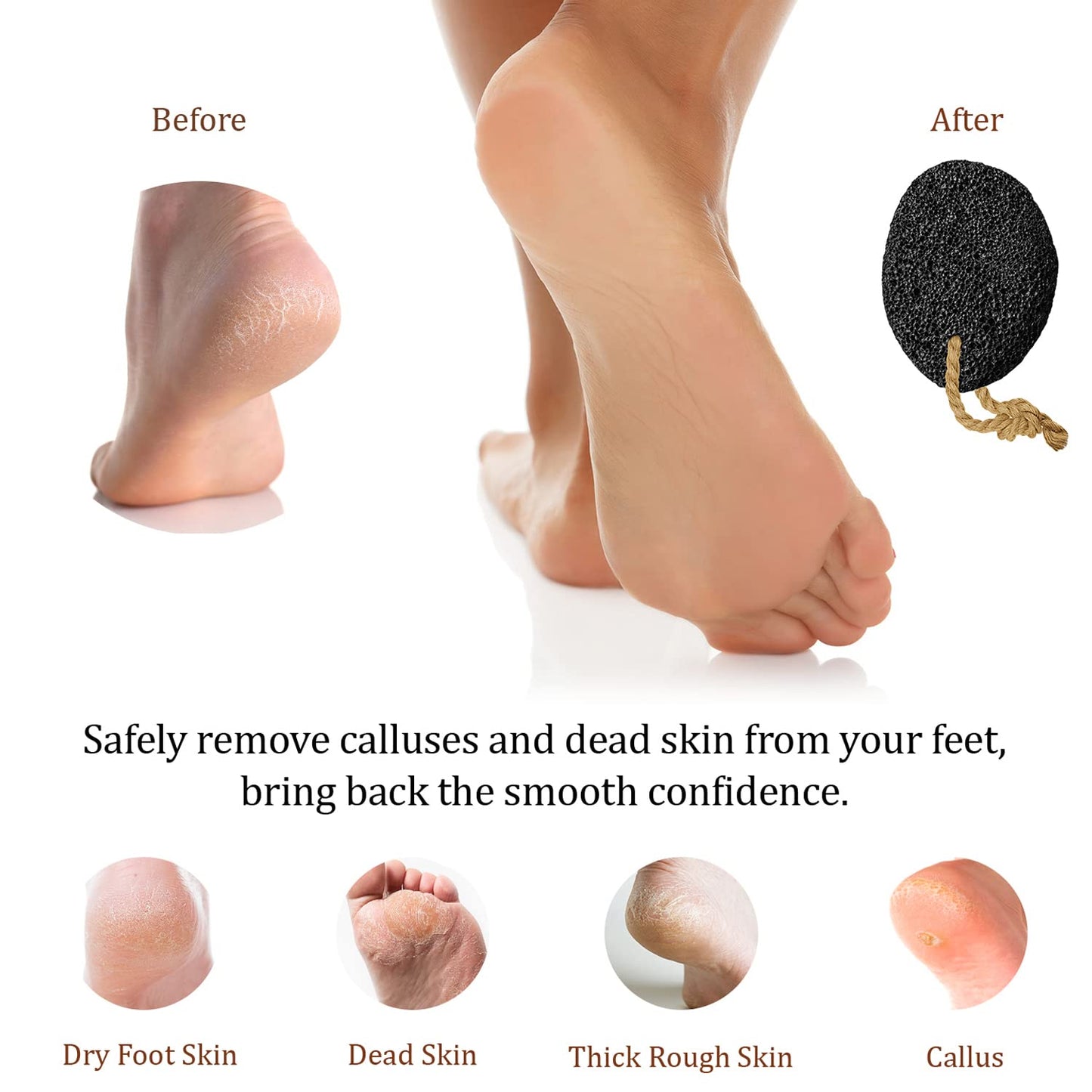 Pumice Stone for Feet - Natural Foot Scrubber for Dead Skin Callus Removal