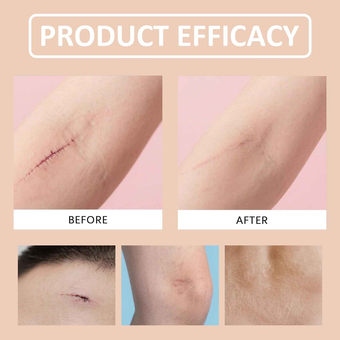 Silicone Scar Stick (2-Pack) - Helps Improve the Appearance of Old & New Scars on Face & Body, For Use After C-Section, Surgery, Acne, Burns - Non-Greasy, Easy-to-Use