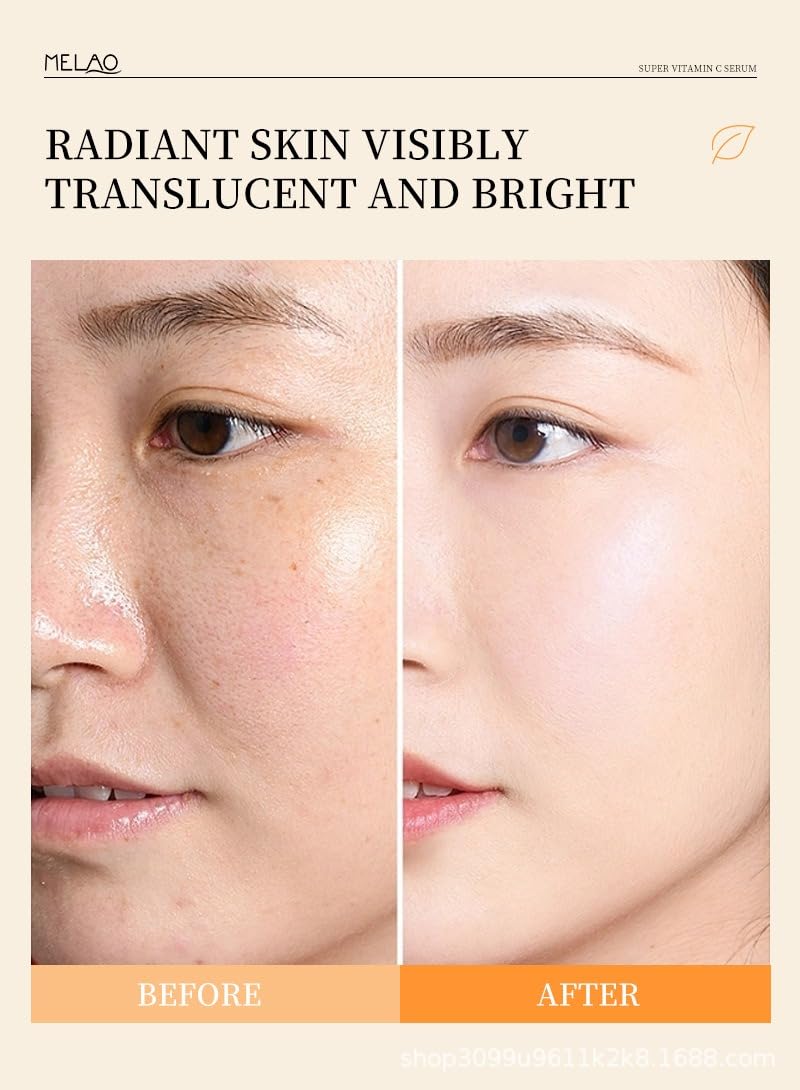 Vitamin C Super Face Serum, 30ml, with Retinol, Niacinamide and Hyaluronic Acid