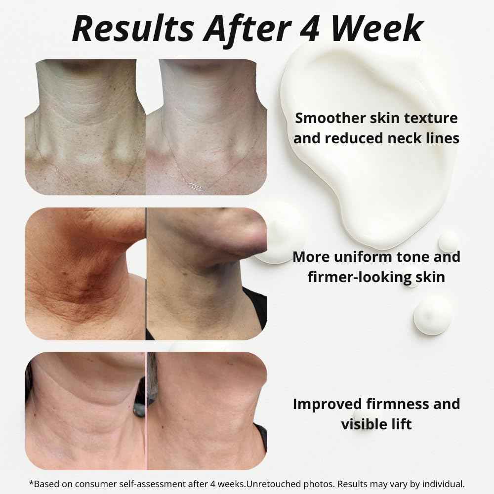 Neck Tightening Cream with Argireline AH-8, Bakuchiol, Hyaluronic Acid & Alpha Arbutin – Firming Moisturizer for Face, Neck & Décolleté – Anti-Wrinkle Cream for Women & Men – 1.76 Oz