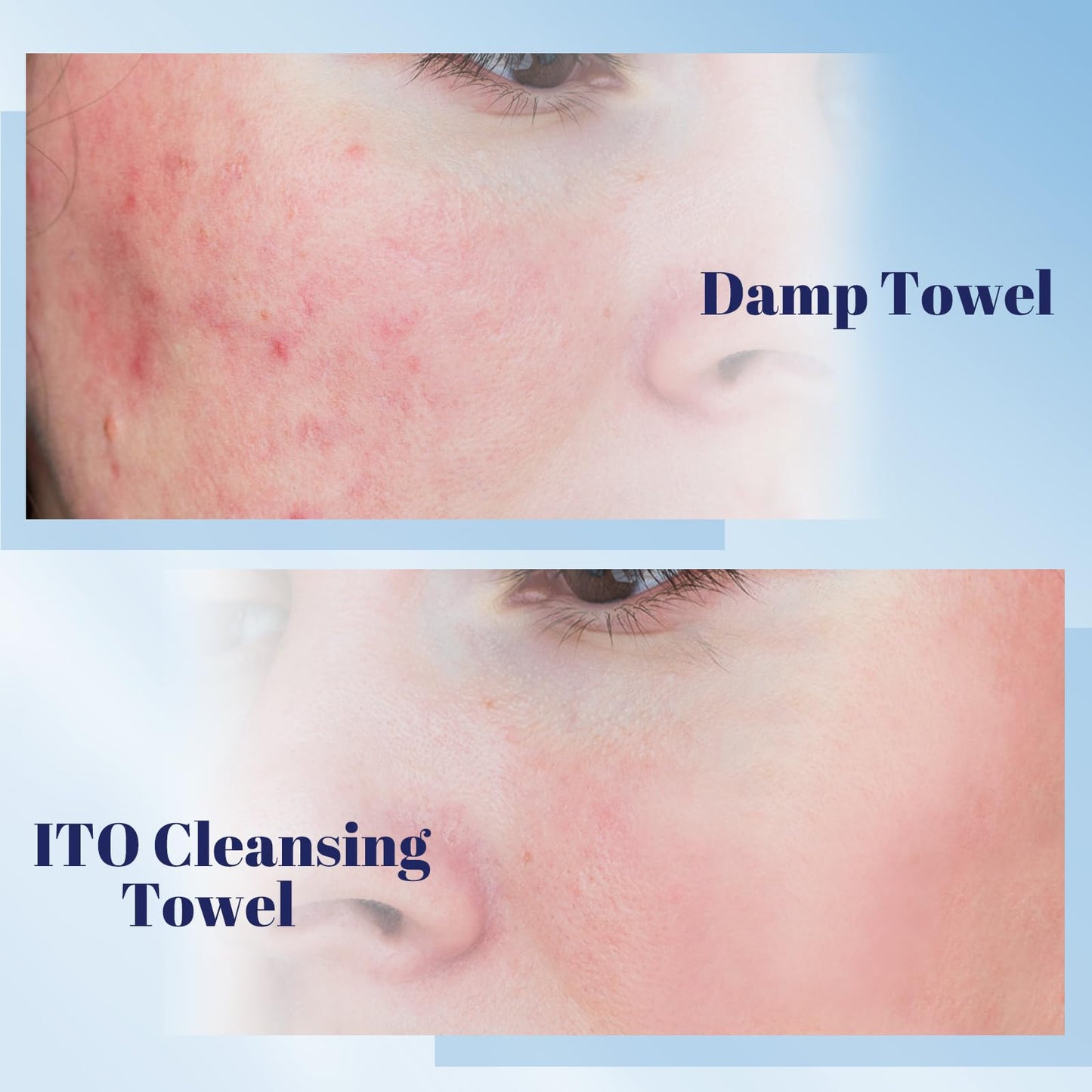 ITO Face Towels, Ultra-Soft & Extra Thick Cleansing Towels for Sensitive, Dry & Oily Skin, Facial Tissue, Makeup Remover Disposable Towels (60 Count (Pack of 3))