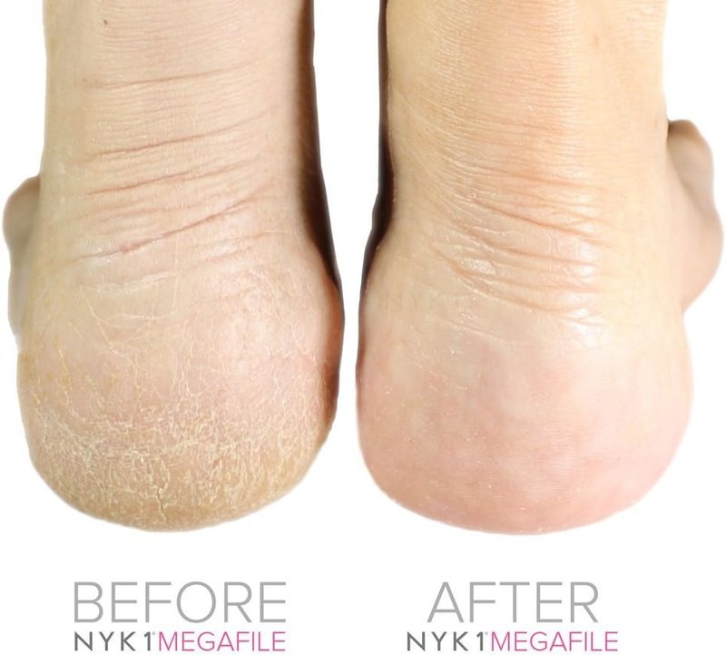 NYK1 Foot File - Original MEGAFILE Pedicure Rasp for Calloused Skin Removal | Extra Large Micro Files