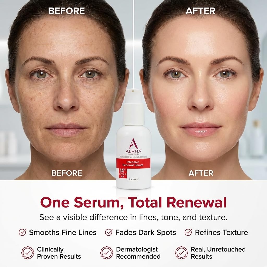 Alpha Skin Care Renewal Serum, 14% Glycolic AHA, Anti-Aging Formula, Reduces Lines & Wrinkles, Alpha Hydroxy Acid Exfoliates & Evens Skin Tones, Rejuvenates & Hydrates, 2 Oz