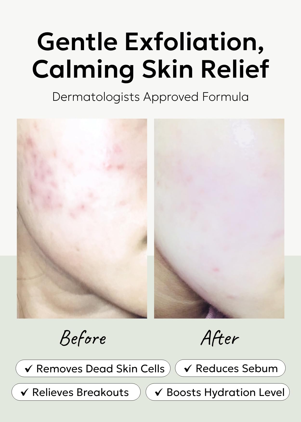 celimax Ji.Woo.Gae Heartleaf BHA Peeling Pad(60 pads) + Ji.Woo.Gae Cica BHA Blemish Toner Pad (60 Pads) Bundle