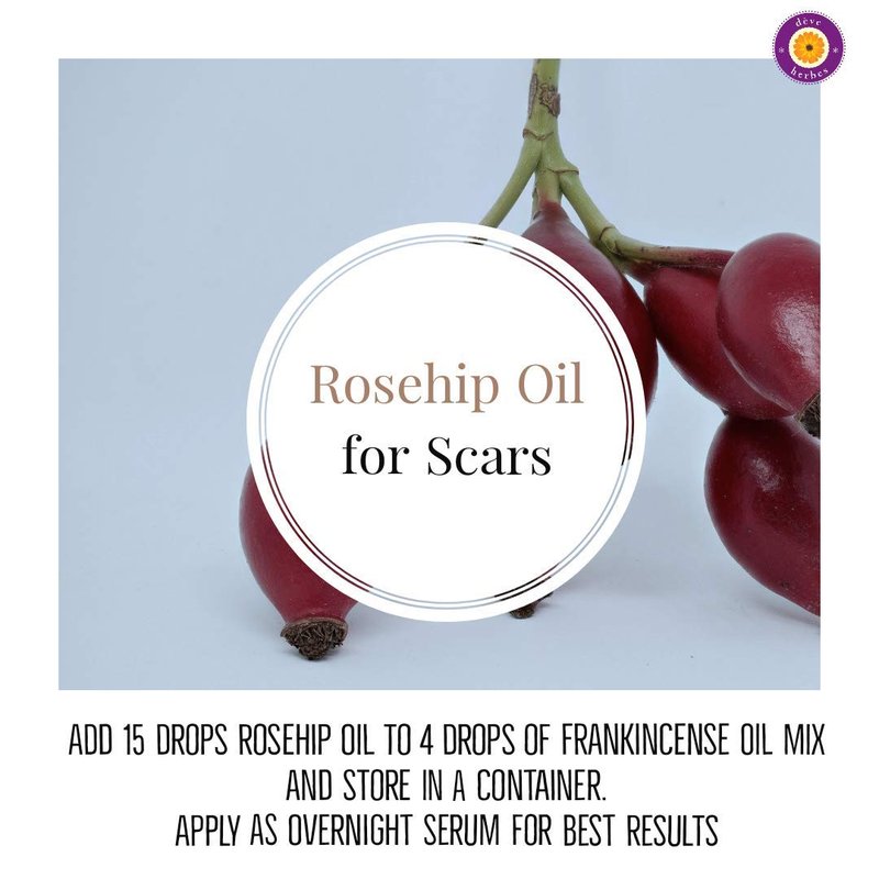 dève herbes Rosehip Oil (Rosa rubiginosa) | Cold Pressed | Pure | Natural | Undiluted | For Diluting Essential oils | For Skin & Massage | Non-Sticky| Lightweight| Men & Women | 50ml (1.69 oz)