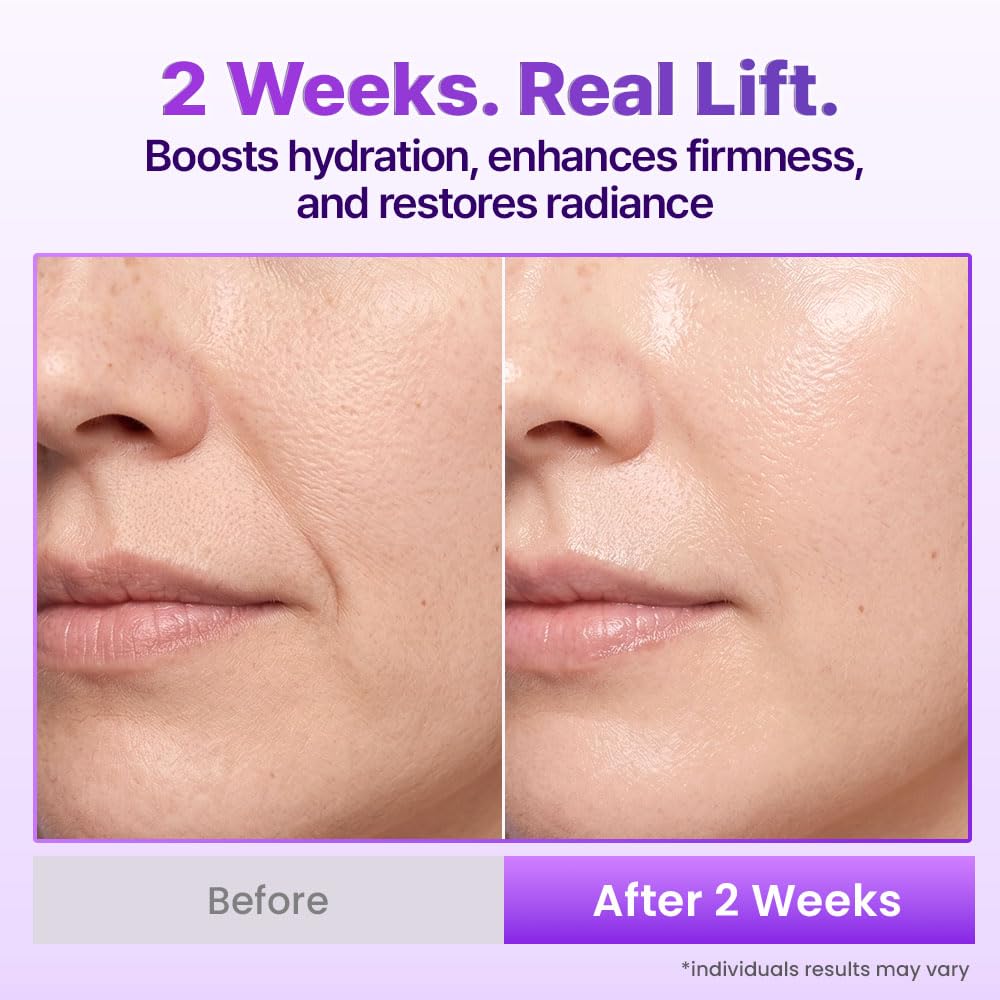 BIOHEAL BOH Probioderm 3D Lifting Cream Mist 3.38 fl oz | Korean Face Mist with Cream-Like Hydration for Instant Glow, Firm-Looking Skin & On-the-Go Refresh