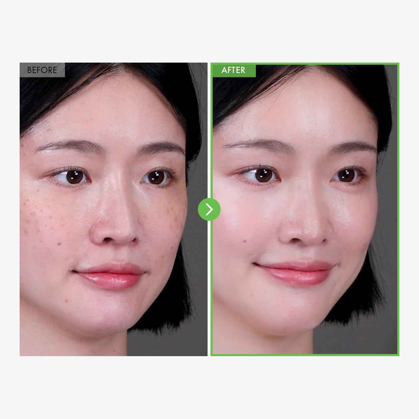 TOSOWOONG Kakadu Plum Blemish Cream, Dark Spot Remover for Face Cream, Kakadu Plum 600,000ppm, Niacinamide, Adenosine, Betaine, Dark Spot Corrector, Vitamin C, Korean Skin Care, 50g, 1.76 oz.