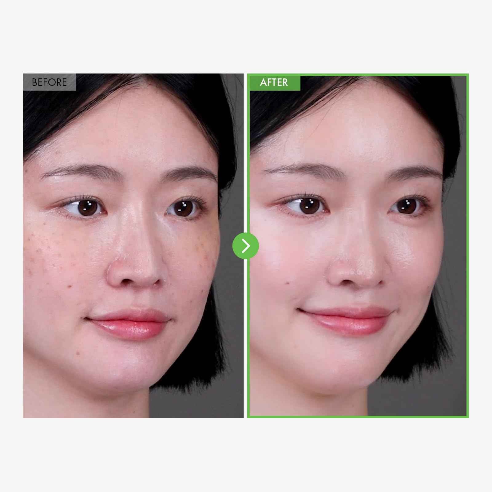 TOSOWOONG Kakadu Plum Blemish Cream, Dark Spot Remover for Face Cream, Kakadu Plum 600,000ppm, Niacinamide, Adenosine, Betaine, Dark Spot Corrector, Vitamin C, Korean Skin Care, 50g, 1.76 oz.