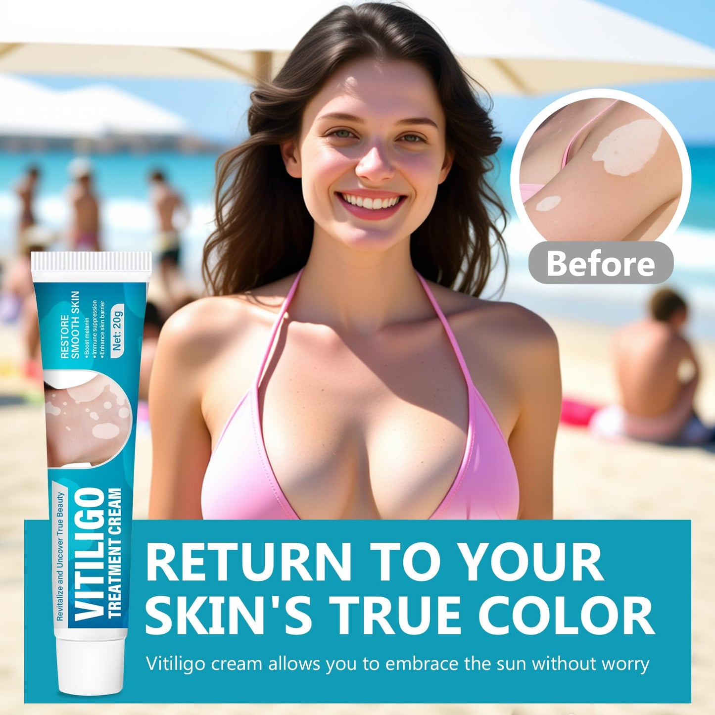 Vitiligo Cream| Effective Treatment of Skin Vitiligo, Reduce Uneven Skin Tone, White Spots, Promote Melanin Production of the Active Ingredients, Suitable for Both Men and Women, 20G