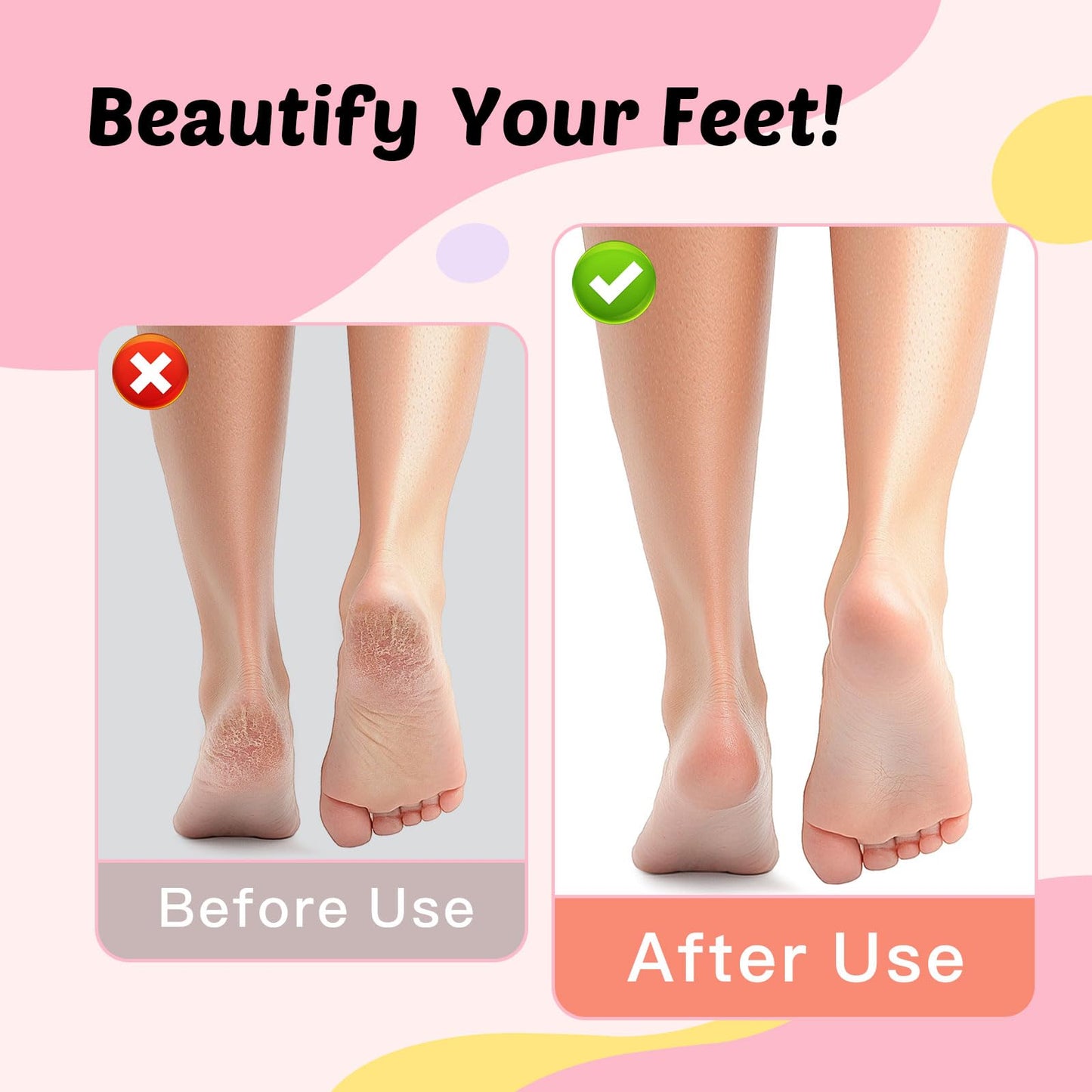 Electric Foot Callus Remover, 9-Speed for Dead Skin & Hard Calluses, Aluminum Alloy, Type-C Rechargeable, Replacement Discs, Spa-Like At-Home Pedicure, Relaxing Self-Care(Gunmetal)