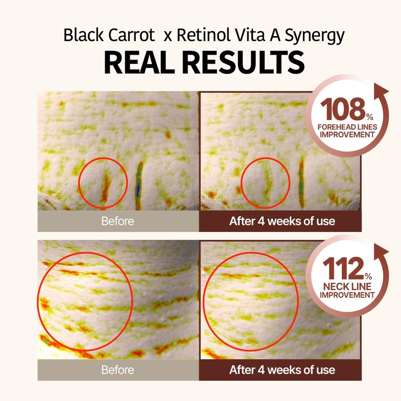 Black Carrot Vita-A Retinol Eye Cream - Smoothing Daily Under Eye Treatment | K-Beauty Skincare