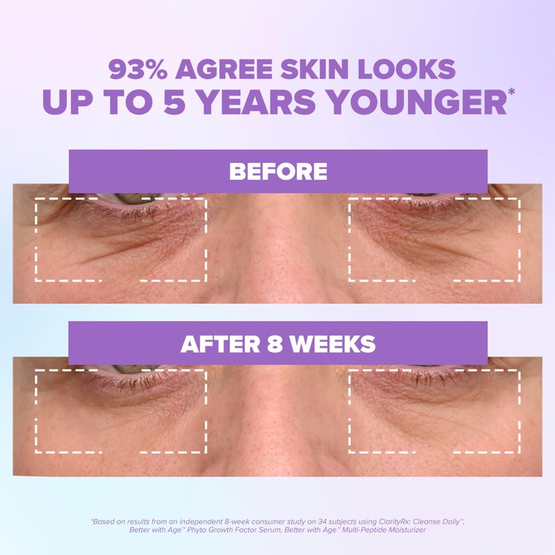 ClarityRx Better With Age Phyto Growth Factor Face Serum, 0.9 Fl Oz, Anti-Aging Hydrating Serum with Plant Stem Cells, Helps Support Collagen & Hyaluronic Acid Production, Visibly Smooths Fine Lines