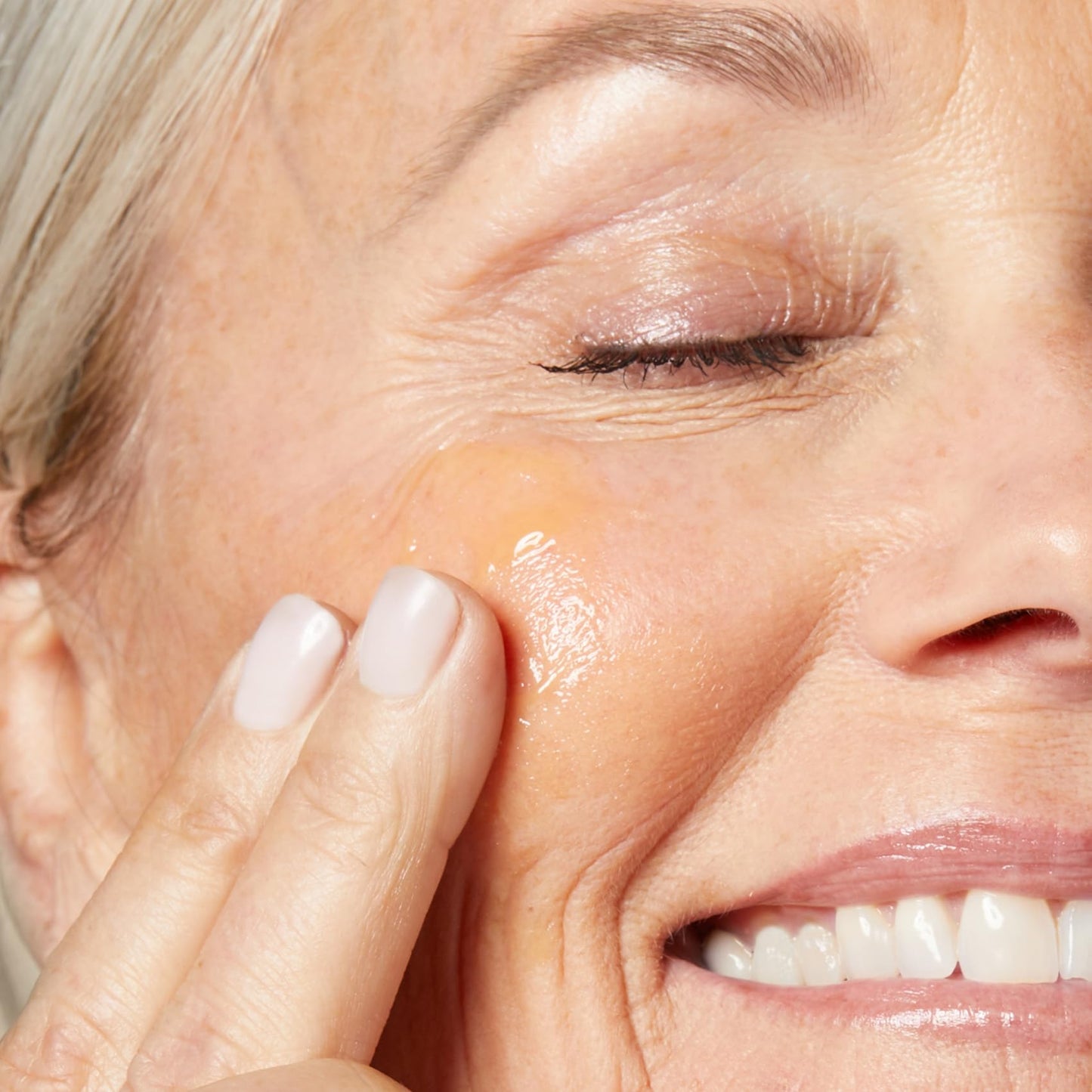 SKINIST The Iluminist 20% Vitamin C Glow Serum – Brightening & Hydrating Formula with Hyaluronic Acid