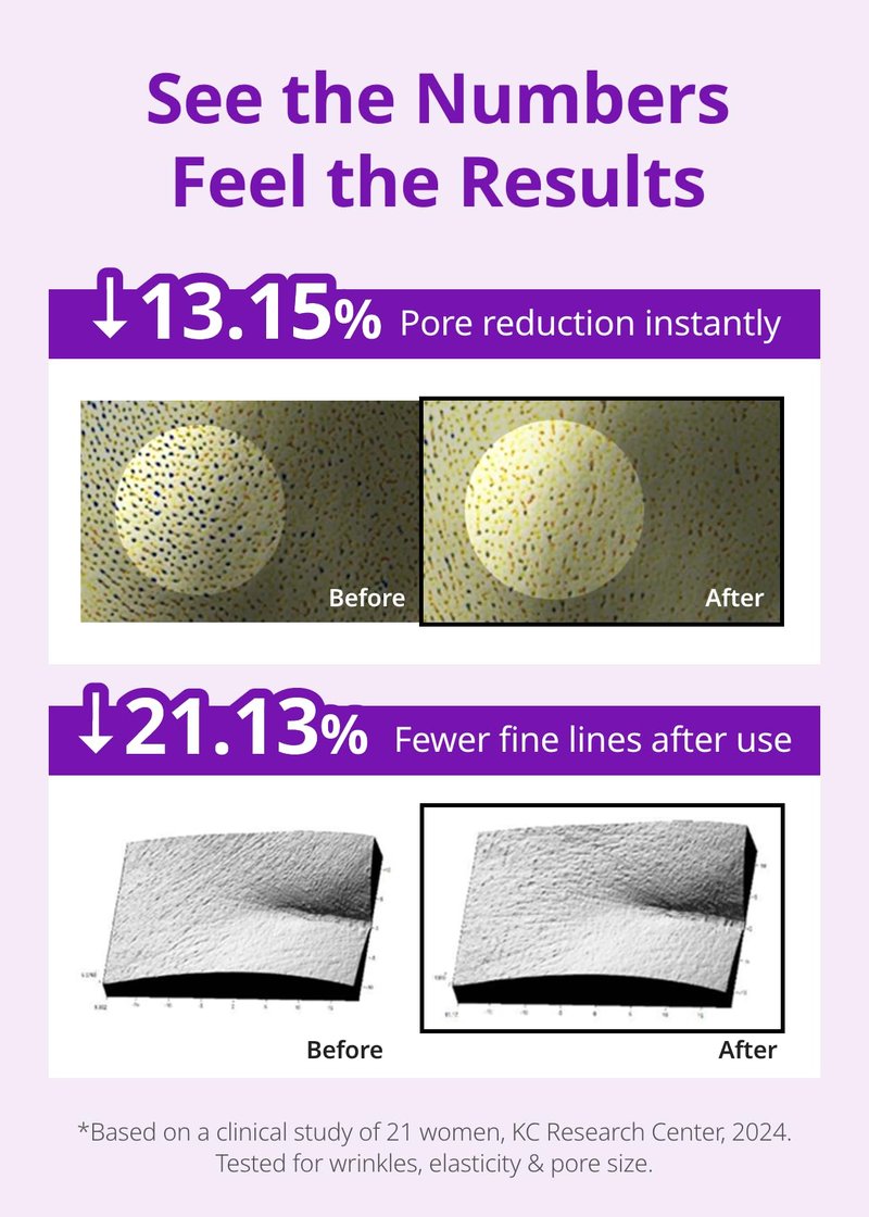 SNP 10,000ppm Deep Collagen + PDRN + Retinol Hydrogel Mask | 8 Layer 125Da Collagen Face Mask | Overnight Facial Mask | Patent Skin Hydration | Hydrating Facial Mask | Face Mask Skin Care | 4 Sheets