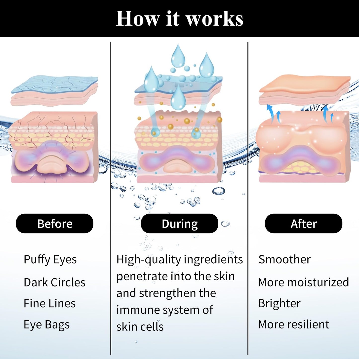 SPRINGSKY Under Eye Patches,Lace Eye Mask for Puffy Eyes and Dark Circles,Collagen Skin Care Products,Hydrating,Smoothing,Anti-Aging Eye Patch for Under Eye Bags（24 Pairs）