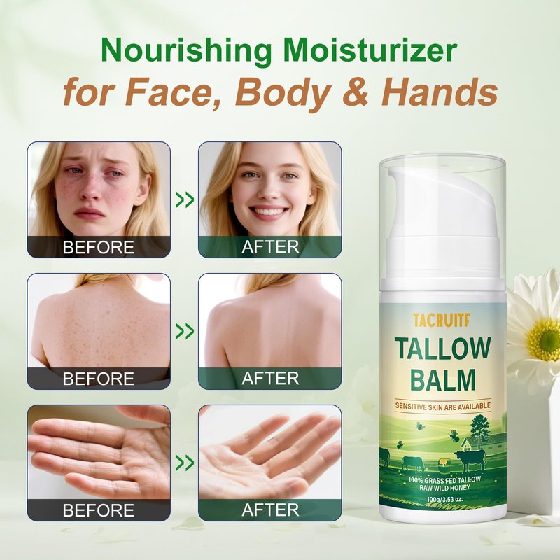 Organic Grass-Fed Beef Tallow & Raw Honey Balm – Handmade Whipped Moisturizer for Face & Body, Soothes Eczema, Rosacea, Dry & Sensitive Skin – Unscented, All-Natural, Chemical-Free (6 Packs / 12oz)