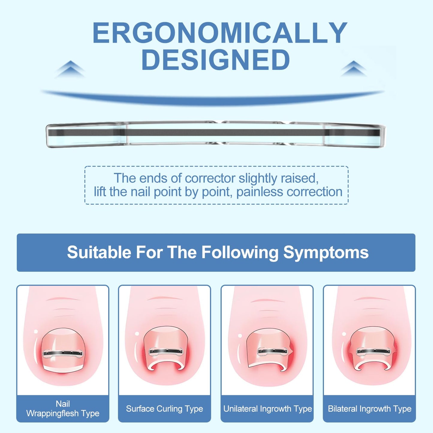 12Pcs Ingrown Toenail Corrector Strips for Curved Toenail Quick Relief,4 Multi-Sizes Ingrown Toenail Treatment Relief Tools Kit for Home Use