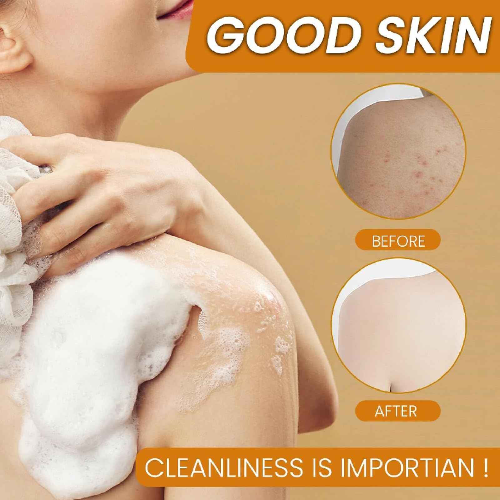 Lemon Turmeric Kojic Soap – Kojic and Turmeric Soap, Jabon De Curcuma Para Las Manchas, TurmericSoap Bar for Face and Body, Moisturizing Deep Cleansing