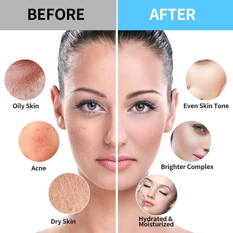Jelly Face Mask Bundle - 24K Gold & Vampire+ Hyaluronic Acid | Hydrating HydroJelly Masks for Facials & Vajacial