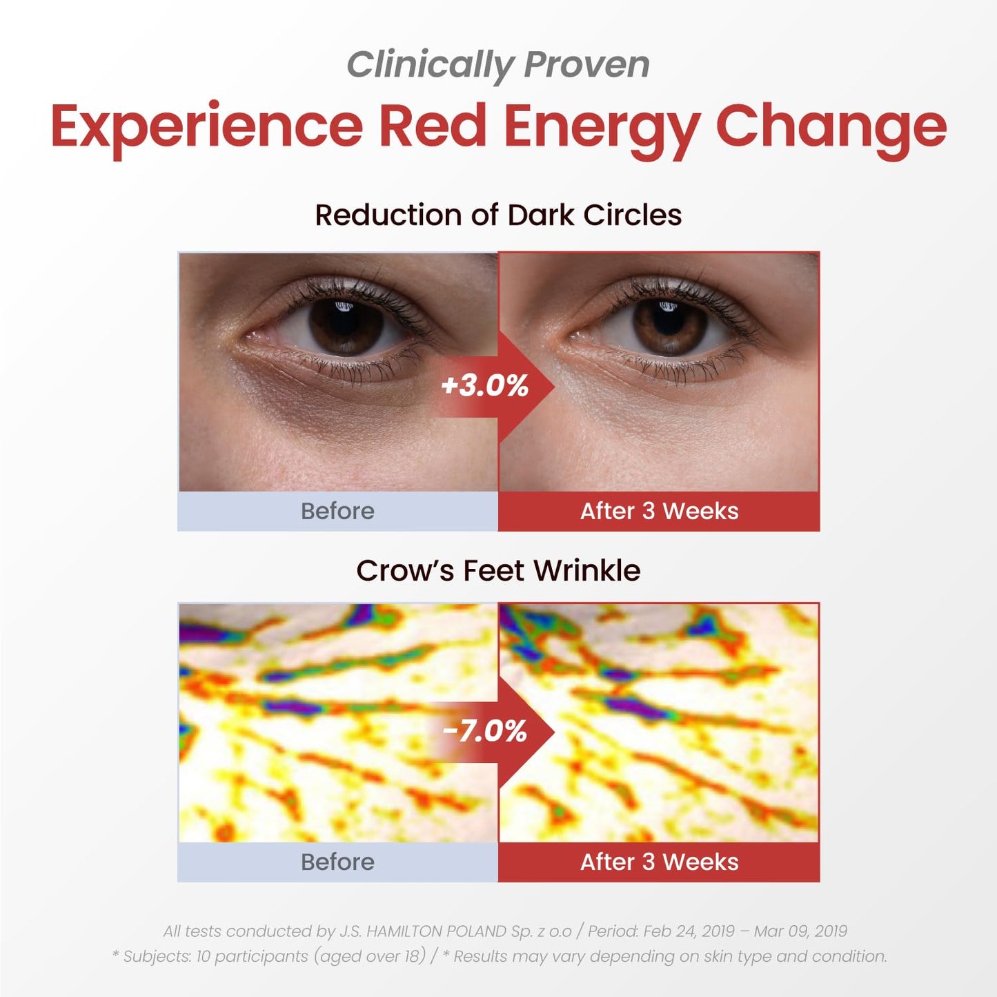 YADAH Red Food Energy Eye Patch 60 Pairs - Hydrogel Under Eye Mask with Pomegranate & Ginseng for Firming, Hydration & Puffiness Reduction.