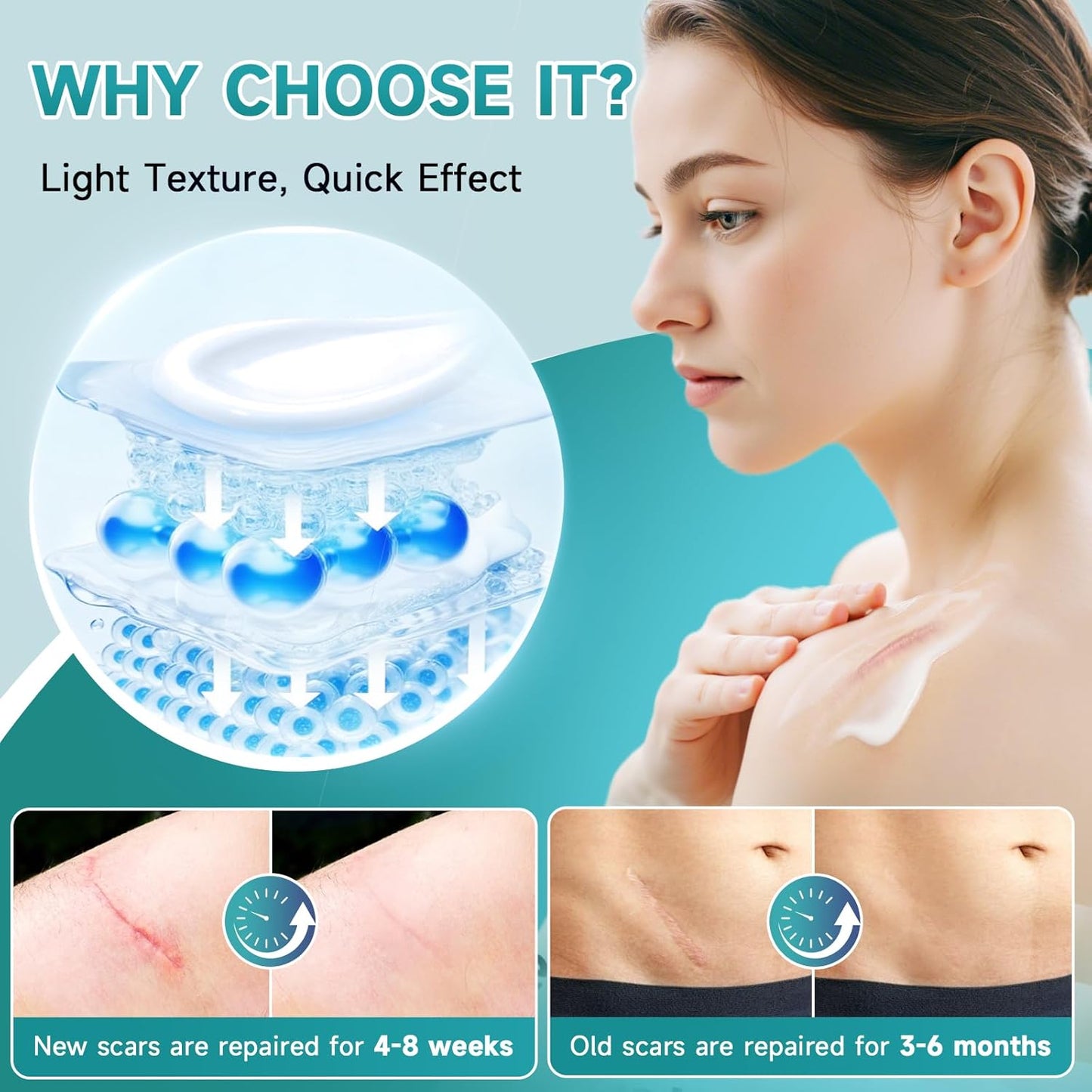 Advanced Scar Cream - Silicone Gel for Surgical Scars, Stretch Marks & More | 1.7 oz (50ml)