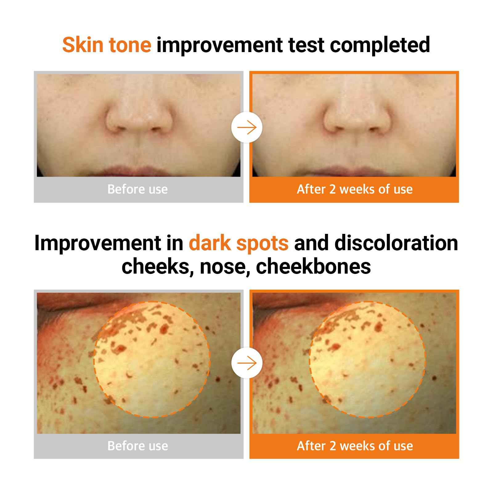 NEAF NEAF Vita PDRN Ampoule, A 30-day ampoule with Licorice PDRN and Vitamin C to improve skin spots and radiance. (20ml /0.68 oz)