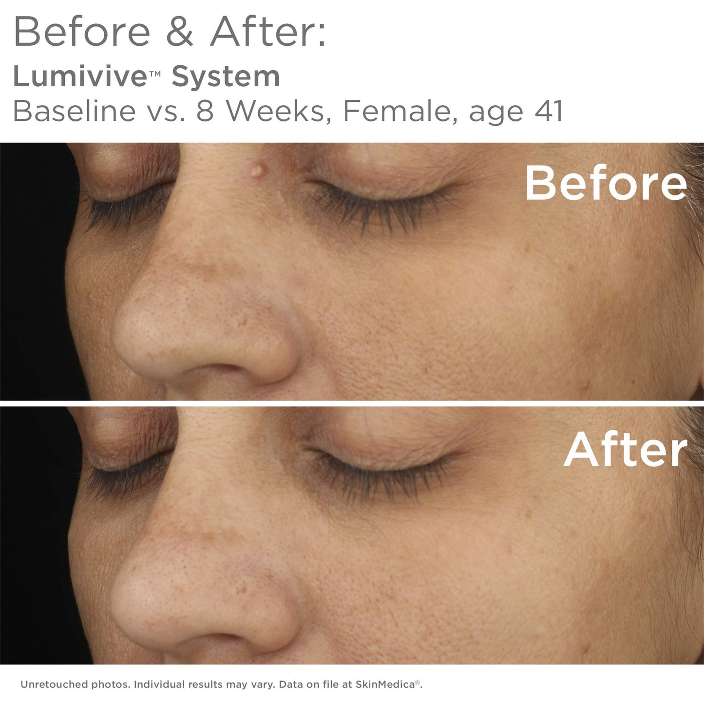 SkinMedica Lumivive Day & Night System - Your Essential Serum Based, Age-Defying Skin Care Set for a Radiant Beauty Routine