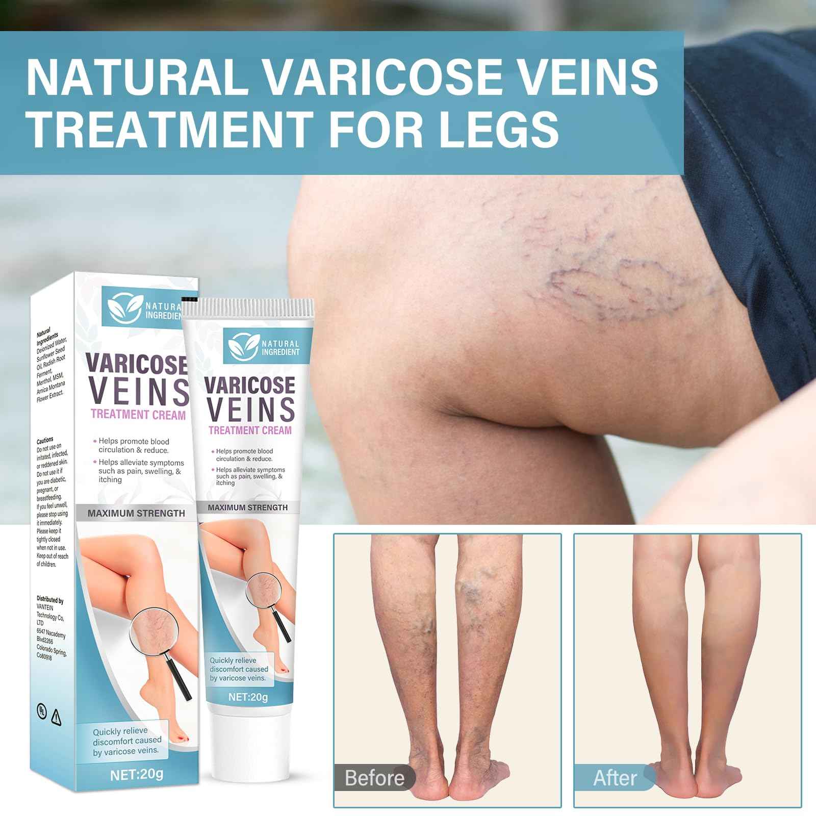 Varicose Veins Treatment for Legs, Varicose Veins Cream - Improves Blood Circulation, Reduces Varicose Veins and Heaviness, 2 Count