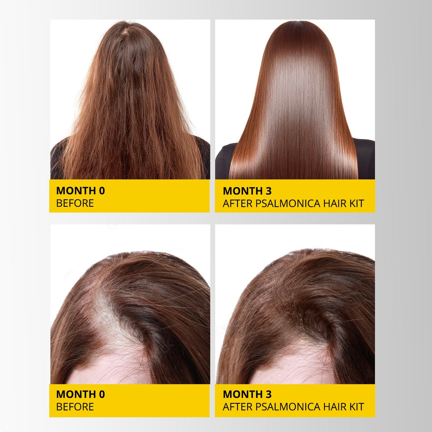 Hair Growth Shampoo and Conditioner Set - Sulfate-Free Thickening Formula for Hair Loss | Regrowth Treatment for Men & Women