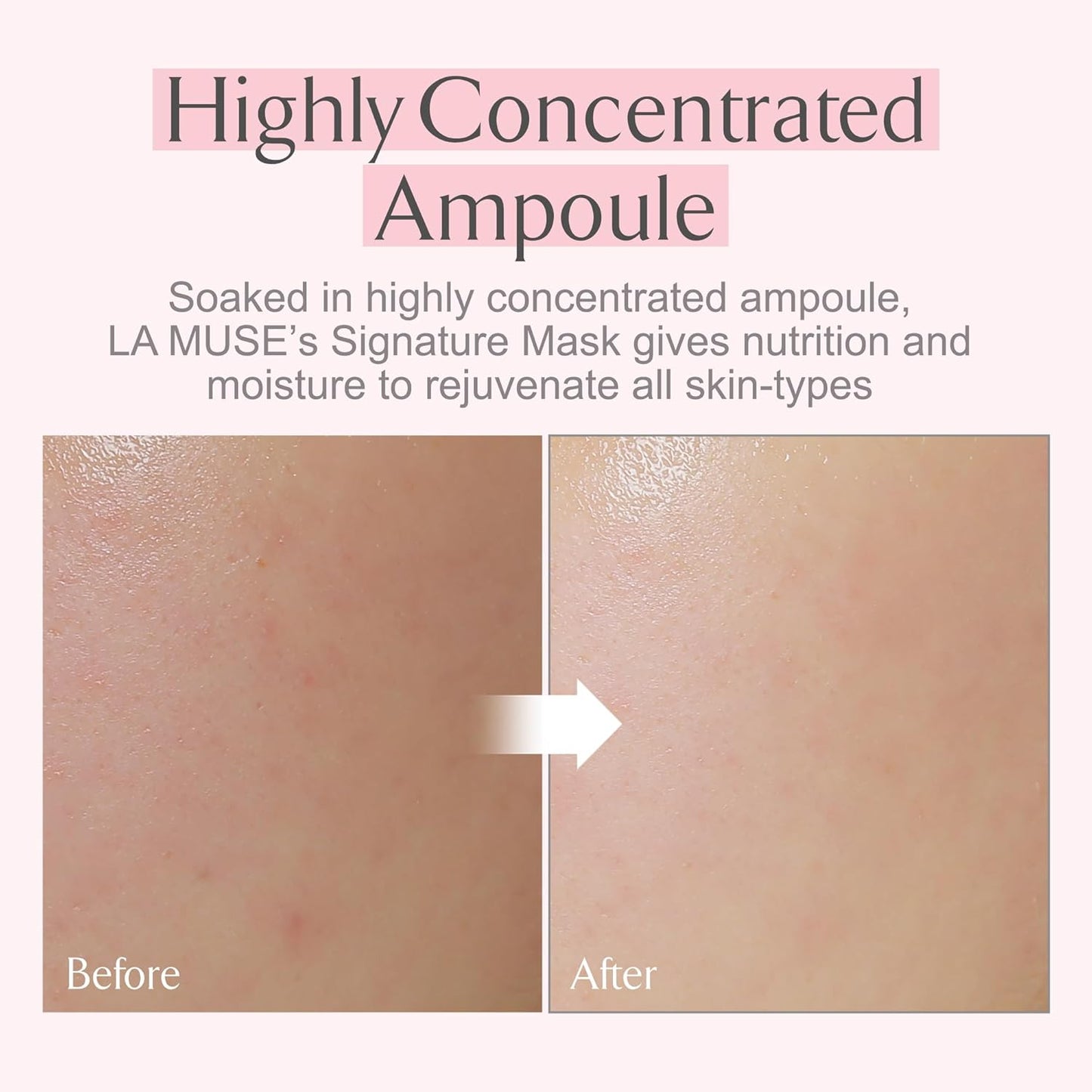 LA MUSE Biocellulose Face Mask - Deep Hydrating & Firming Skin Repair | 5 Pack | Cooling & Soothing Care