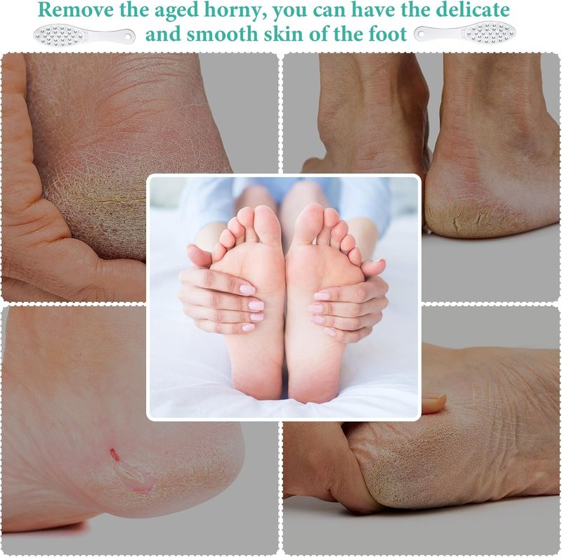 Stainless Steel Foot File Callus Remover - Double-Sided Metal Rasp for Professional Pedicure | Easy to Clean, Classic Style