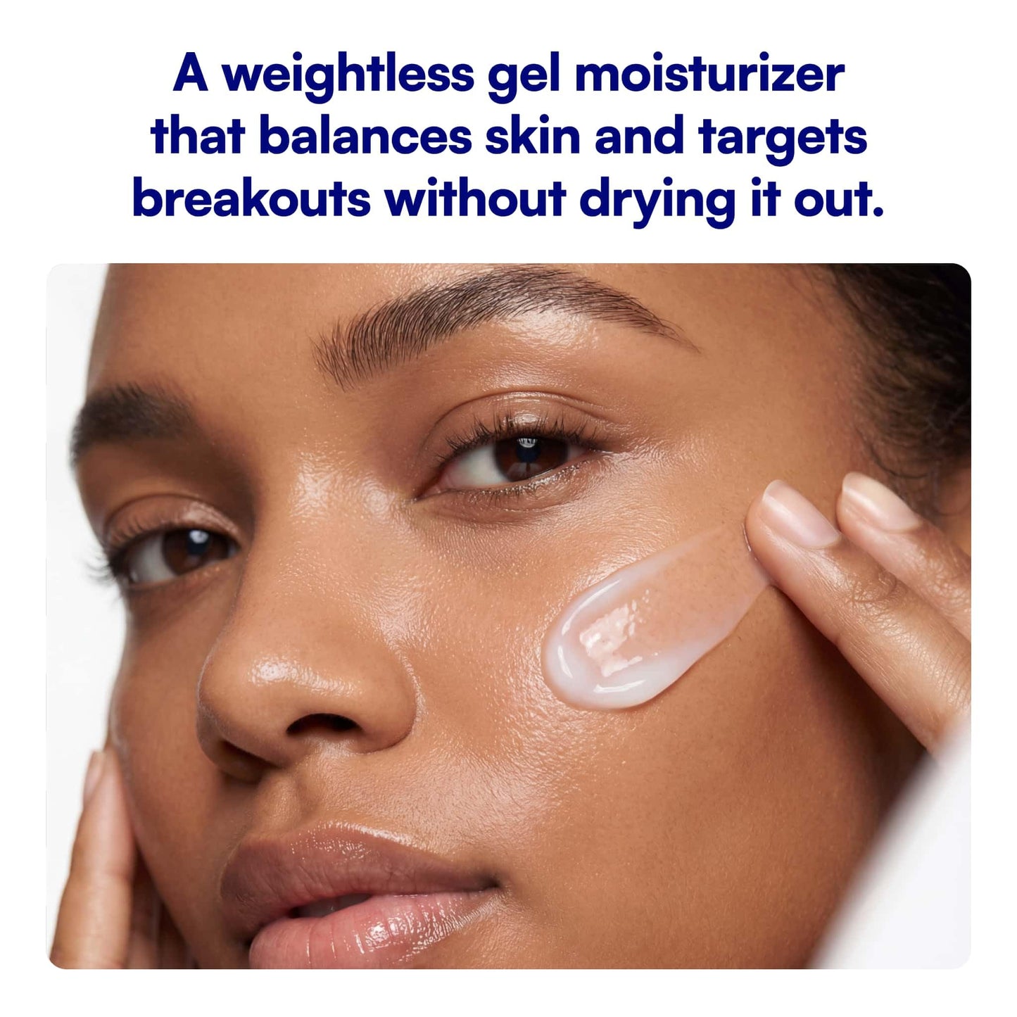 Bliss Clear Genius Clarifying Gel Moisturizer, CLARITY 5 Complex with Salicylic Acid, Niacinamide & Witch Hazel for Blemish-Prone & Oily Skin, Minimizes Pores, 1.7 fl oz