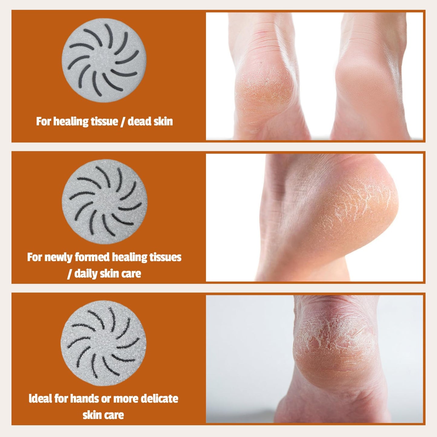 Meyluth Electric Foot Scrubber File Callus Remover with Absorb Function, Waterproof Foot Grinder Cracked Dry Dead Skin Removal for Feet Care, 3 Rollers, 2 Speed, Battery Display