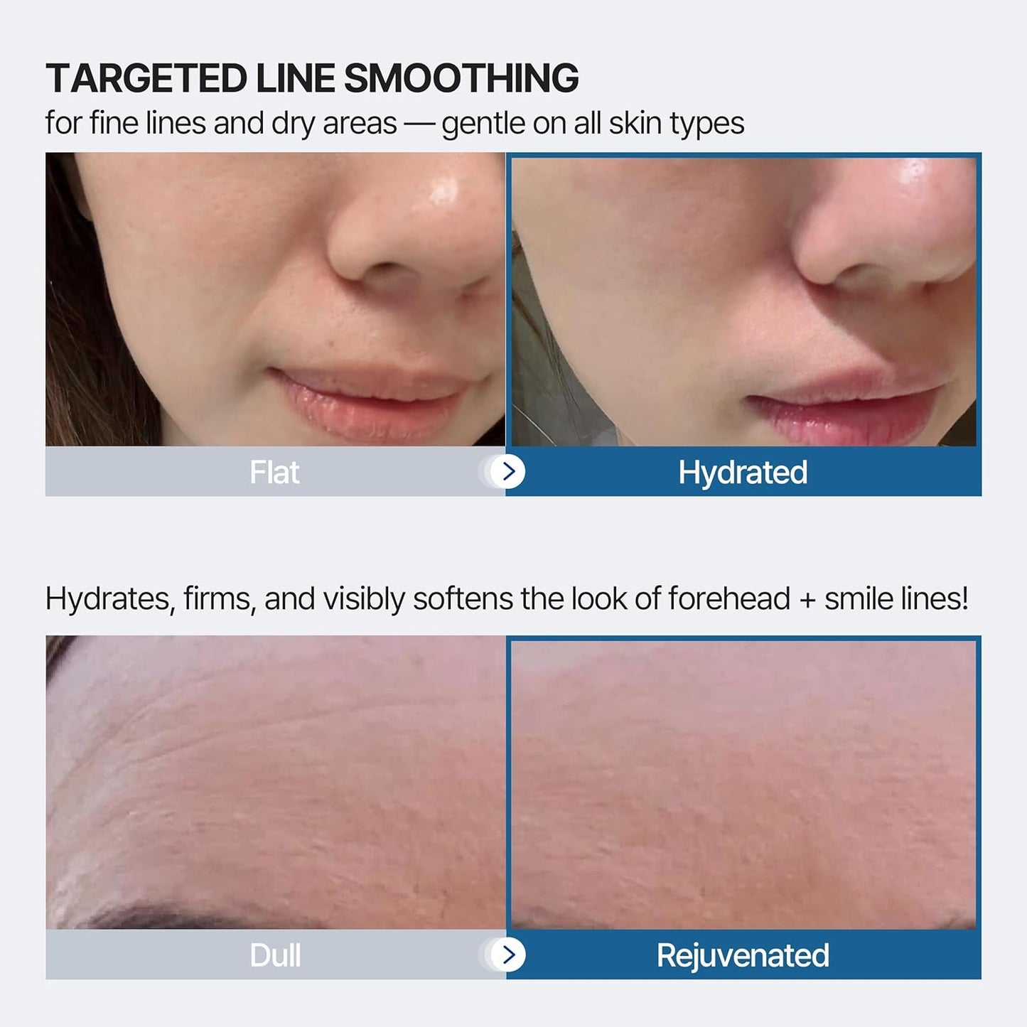 Wrinkle Patches for Forehead & Smile Lines - 36 PCS Hyaluronic Acid, Collagen, Peptides | Smoothing & Firming Treatment
