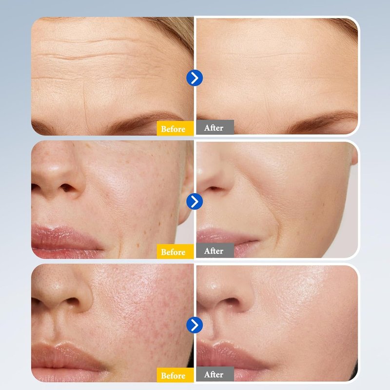 Retinol Collagen Serum - Anti-Aging & Wrinkle Repair with Squalane | Deep Hydration & Firming Formula, 1.70 Fl Oz