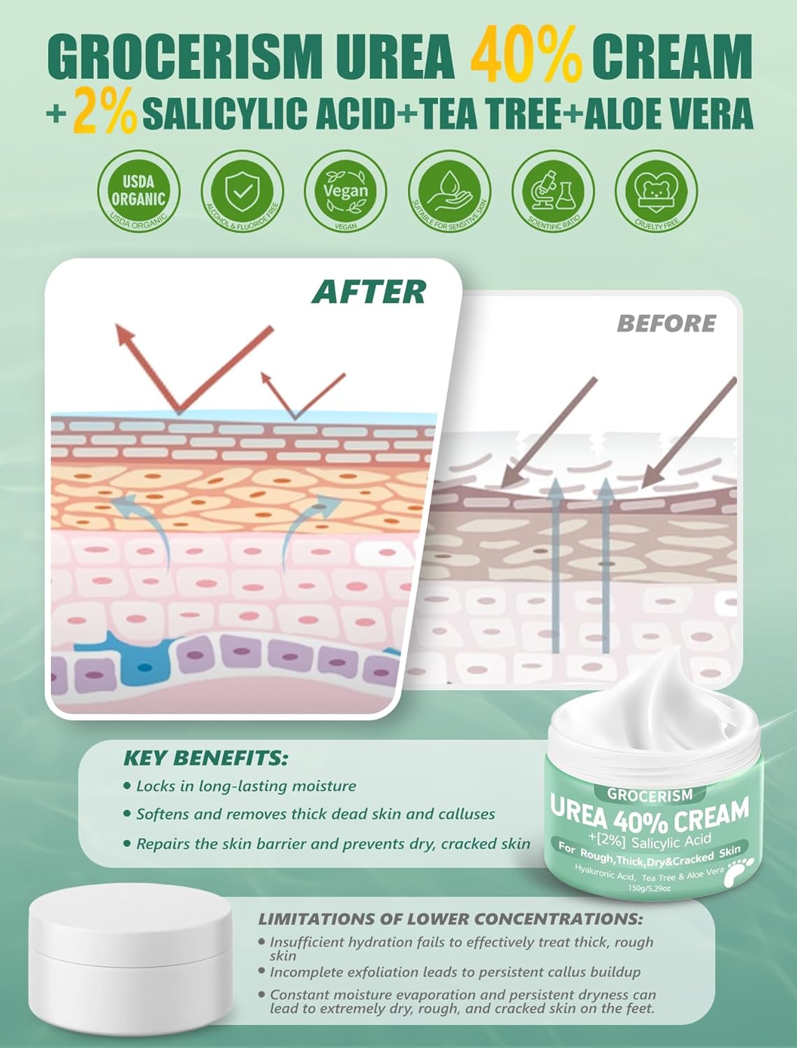Urea Cream 40% with Salicylic Acid - Maximum Strength Foot Cream | 5.30 oz, Deep Moisturizing with Hyaluronic Acid & Aloe Vera